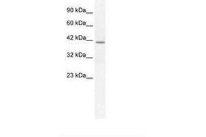 Image no. 1 for anti-Secreted phosphoprotein 1 (SPP1) (C-Term) antibody (ABIN203280) (Osteopontin 抗体  (C-Term))