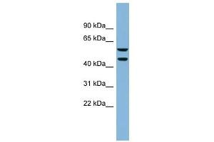 KLHDC4 antibody used at 1 ug/ml to detect target protein. (KLHDC4 抗体  (N-Term))