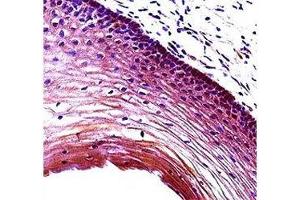 Puma antibody immunohistochemistry analysis in formalin fixed and paraffin embedded human cervix tissue. (PUMA 抗体  (AA 109-137))