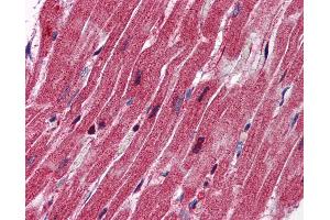 Anti-Nestin antibody IHC of human heart. (Nestin 抗体  (AA 1295-1344))