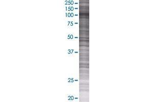 BRD2 transfected lysate. (BRD2 293T Cell Transient Overexpression Lysate(Denatured))