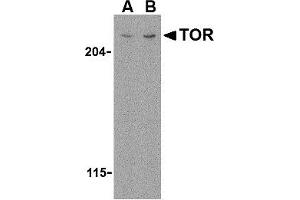 Western Blotting (WB) image for anti-RAR-Related Orphan Receptor C (RORC) (N-Term) antibody (ABIN1031636) (RORC 抗体  (N-Term))