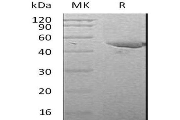 PAI1 Protein (His tag)