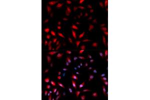 Immunofluorescence (IF) image for anti-Heat Shock 27kDa Protein 1 (HSPB1) (pSer82) antibody (ABIN1870246) (HSP27 抗体  (pSer82))