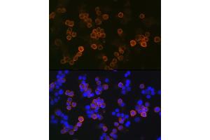 Immunofluorescence analysis of Raw264 7 cells using iNOS Rabbit mAb (ABIN1678965, ABIN3018084, ABIN3018085 and ABIN7101575) at dilution of 1:100 (40x lens). (NOS2 抗体)