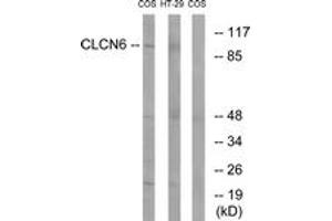 Western Blotting (WB) image for anti-Chloride Channel, Voltage-Sensitive 6 (CLCN6) (AA 611-660) antibody (ABIN2890213) (CLCN6 抗体  (AA 611-660))