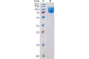 Human CD117 Protein, His Tag on SDS-PAGE under reducing condition. (KIT Protein (AA 26-520) (His tag))