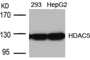 Image no. 1 for anti-Histone Deacetylase 5 (HDAC5) (AA 496-500) antibody (ABIN197341) (HDAC5 抗体  (AA 496-500))