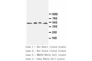 Image no. 1 for anti-Cathepsin D (CTSD) antibody (ABIN1502057) (Cathepsin D 抗体)