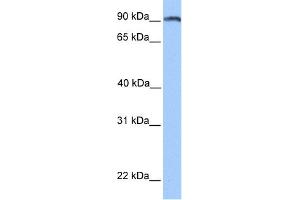 WB Suggested Anti-ANKS3 Antibody Titration: 0. (ANKS3 抗体  (N-Term))