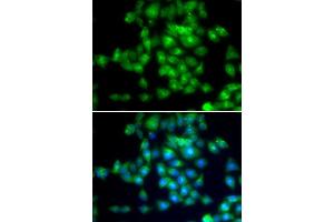 Immunofluorescence analysis of MCF-7 cells using SIRT3 antibody. (SIRT3 抗体  (C-Term))