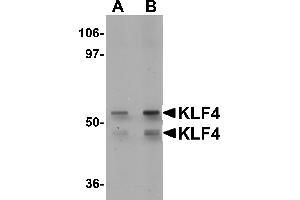 Western Blotting (WB) image for anti-Kruppel-Like Factor 4 (Gut) (KLF4) (C-Term) antibody (ABIN1030469) (KLF4 抗体  (C-Term))