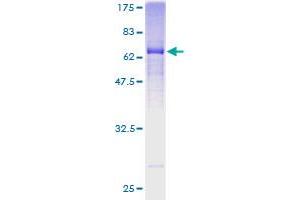 Image no. 1 for Spondin 2 (SPON2) (AA 27-331) protein (GST tag) (ABIN1321223) (SPON2 Protein (AA 27-331) (GST tag))