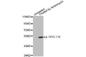 Western blot analysis of extracts from MDA cells, using phospho-TP53-T18 antibody. (p53 抗体  (pThr18))