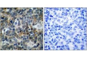 Immunohistochemistry (IHC) image for anti-Vasodilator-Stimulated phosphoprotein (VASP) (pSer238) antibody (ABIN605395) (VASP 抗体  (pSer238))