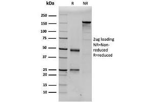 SDS-PAGE Analysis Purified Prolactin Mouse Monoclonal Antibody (PRL/2643). (Prolactin 抗体  (AA 63-201))