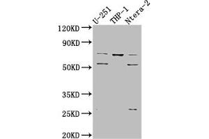 Western Blot Positive WB detected in: U-251 whole cell lysate, THP-1 whole cell lysate, Ntera-2 whole cell lysate All lanes: PTH1R antibody at 1:1000 Secondary Goat polyclonal to rabbit IgG at 1/50000 dilution Predicted band size: 67 kDa Observed band size: 72, 55 kDa (Recombinant PTH1R 抗体)