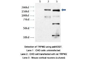 Image no. 2 for anti-Transient Receptor Potential Cation Channel, Subfamily M, Member 2 (TRPM2) (AA 1430-1508), (C-Term) antibody (ABIN363636) (TRPM2 抗体  (C-Term))