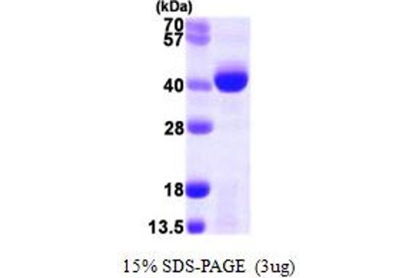 ALKBH3 Protein (AA 1-286) (His tag)