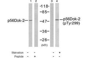 Image no. 1 for anti-DOK2 (DOK2) (pTyr299) antibody (ABIN197044) (DOK2 抗体  (pTyr299))