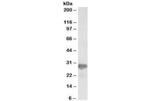 Western blot testing of HeLa lysate with NNMT antibody at 0. (NNMT 抗体)