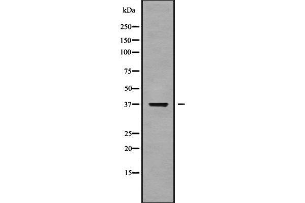 NEIL2 抗体  (Internal Region)