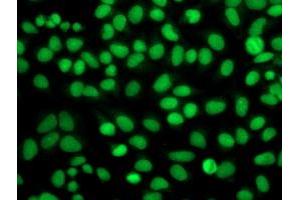Immunofluorescence (IF) image for anti-Fibroblast Growth Factor Receptor 2 (FGFR2) antibody (ABIN1498250) (FGFR2 抗体)