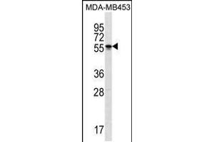 Western blot analysis in MDA-MB453 cell line lysates (35ug/lane). (SOHLH2 抗体  (AA 232-258))