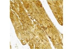 Immunohistochemistry (IHC) image for anti-Caspase 7, Apoptosis-Related Cysteine Peptidase (CASP7) (C-Term) antibody (ABIN1030318) (Caspase 7 抗体  (C-Term))