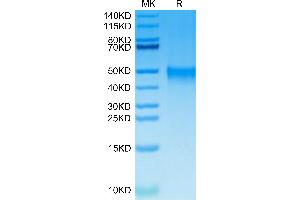 CRLF2 Protein (AA 23-231) (His tag)