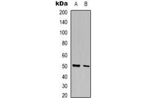 Western blot analysis of AGXT2L2 expression in HepG2 (A), A431 (B) whole cell lysates. (AGXT2L2 抗体  (C-Term))