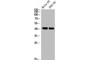 Western blot analysis of HELA-UV 293T-UV using p-Rad51 (T309) antibody. (RAD51 抗体  (pThr309))