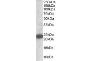 ABIN2560214 staining (1µg/ml) of Human Brain lysate (RIPA buffer, 35µg total protein per lane). (STMN2 抗体  (N-Term))