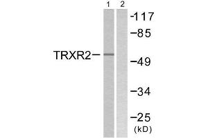 Western Blotting (WB) image for anti-Thioredoxin Reductase 2 (TXNRD2) (C-Term) antibody (ABIN1848862) (TXNRD2 抗体  (C-Term))