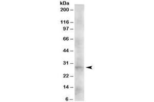Western blot testing of human heart lysate with DKK2 antibody at 2ug/ml. (DKK2 抗体)
