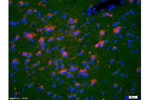 Formalin-fixed and paraffin-embedded rat brain labeled with Anti-TSHR Polyclonal Antibody, Unconjugated (ABIN723470) 1:200, overnight at 4°C, The secondary antibody was Goat Anti-Rabbit IgG, Cy3 conjugated used at 1:200 dilution for 40 minutes at 37°C. (TSH receptor 抗体  (AA 31-100))