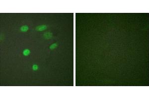 P-peptide - +Immunofluorescence analysis of HeLa cells, using CDC16/APC6 (Phospho-Ser560) antibody. (CDC16 抗体  (pSer560))