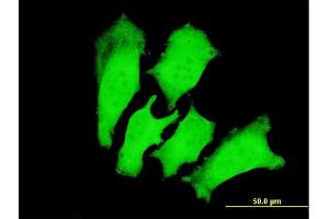 Immunofluorescence (IF) image for anti-Cardiac Troponin I (TNNI3) (AA 102-210) antibody (ABIN563216)
