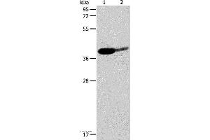 Western blot analysis of Mouse brain and human liver cancer tissue, using SIRT3 Polyclonal Antibody at dilution of 1:500 (SIRT3 抗体)