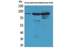 Western Blotting (WB) image for anti-HRS (HRS) (Internal Region) antibody (ABIN6287298) (HRS (HRS) (Internal Region) 抗体)