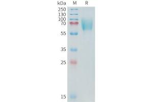 Cynomolgus B7-H3 Protein, His Tag on SDS-PAGE under reducing condition. (CD276 Protein (CD276) (AA 29-465) (His tag))