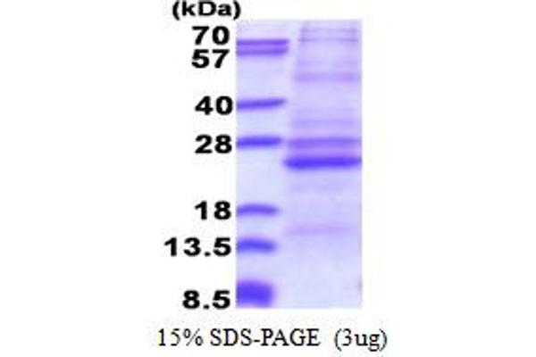 ATP5F1 Protein (AA 83-256) (His tag)