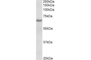 Western Blotting (WB) image for anti-Cytochrome B5 Reductase 4 (CYB5R4) (Internal Region) antibody (ABIN2465085) (CYB5R4 抗体  (Internal Region))