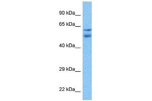 Host:  Rabbit  Target Name:  TTC6  Sample Tissue:  Liver Tumor lysates  Antibody Dilution:  1ug/ml (TTC6 抗体  (N-Term))