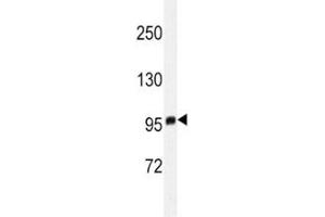 Western blot analysis of EZH2 antibody in T47D lysate. (EZH2 抗体)