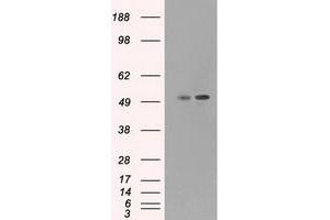 HEK293T cells were transfected with the pCMV6-ENTRY control (Left lane) or pCMV6-ENTRY CD4 (Right lane) cDNA for 48 hrs and lysed. (CD4 抗体)