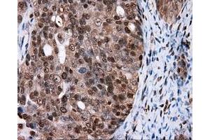 Immunohistochemical staining of paraffin-embedded colon tissue using anti-FAHD2A mouse monoclonal antibody. (FAHD2A 抗体)