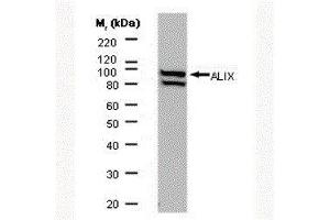 Western Blotting (WB) image for anti-Programmed Cell Death 6 Interacting Protein (PDCD6IP) antibody (ABIN2477348) (ALIX 抗体)