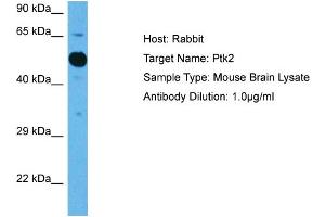 Host: Mouse Target Name: PTK2 Sample Tissue: Mouse Brain Antibody Dilution: 1ug/ml (FAK 抗体  (Middle Region))