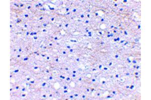 Immunohistochemistry of BRAL1 Antibody Immunohistochemistry of BRAL1 antibody. (HAPLN2 抗体  (Internal Region))